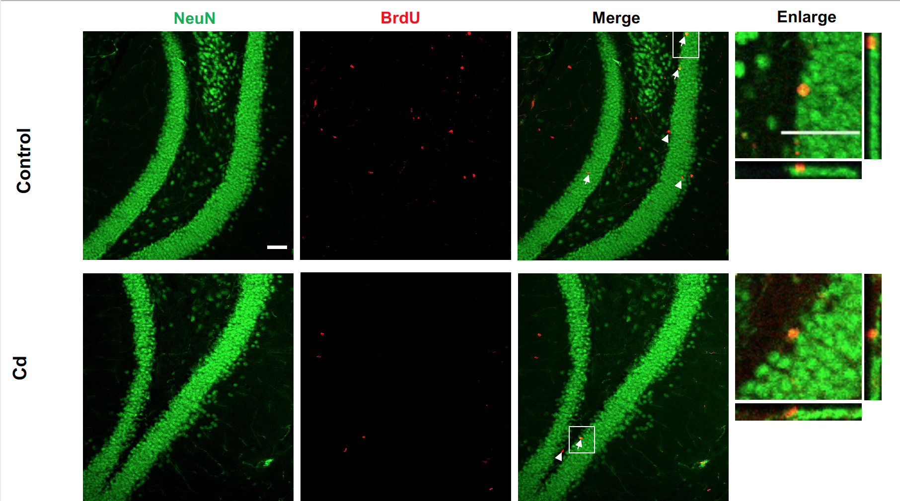 Images of slices of brain tissue with mature neurons fluorescing green and brand new cells fluorescing red.